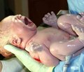Клиническое наблюдение ребенка c врожденной  гиперплазией коры надпочечниковых желез
