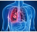 Drug management of oxidation-reduction state of the body in respiratory tract diseases (part 4)