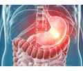 Gastric motility disorders in adolescents with gastroesophageal reflux disease  and functional dyspepsia