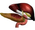 Treatment and prevention of hepatic failure in acute biliary pancreatitis in patients with diabetes mellitus