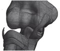 Біомеханічне визначення стабільності  ліктьового суглоба при переломах головки променевої кістки, комбінованих  із пошкодженням колатеральних зв’язок