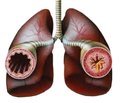 Peculiarities of bronchial asthma persistence in schoolchildren depending on adrenal cortisol-producing function