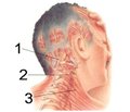 Современные тенденции в диагностике редких форм головной боли (обзор литературы  и клиническое наблюдение)