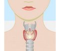 Comments on the 2018 European Thyroid Association Guidelines for the management of amiodarone-associated thyroid dysfunction