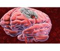 Вплив Медотиліну на функціональний стан головного мозку в пацієнтів, які перенесли гострі порушення мозкового кровообігу за ішемічним типом