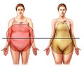 The relation of the dynamics of anthropometric data in obese women of childbearing age with treatment type