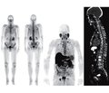 Modern directions of radionuclide diagnosis in patients with prostate cancer