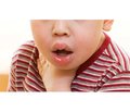 Peculiarities of the development, course and diagnostic principles of food anaphylaxis in toddlers