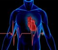 Особливості варіабельності ритму серця у хворих на цукровий діабет 2-го типу з кардіоваскулярною формою діабетичної автономної невропатії серця