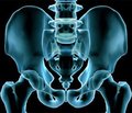 Роль аппарата внешней фиксации при переломах костей таза с повреждением вертлужной впадины
