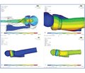 Сравнительный анализ напряжений в системе «кость — имплантат» при эндопротезировании головки лучевой кости разными конструкциями