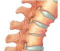 Clinical aspects of cervical spine traumatic injury biomechanics