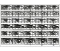 Саккадическое глазодвижение в структуре нейролептического экстрапирамидного расстройства. Взгляд невролога