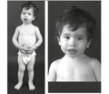 Orphan hereditary syndromes in childish endocrinologist