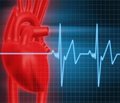 Issues of diagnostics and monitoring of cardiac dysturbances in children after surgical correction of congenital heart disease