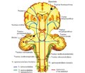 Case analysis of crossed cerebellar hemispheric diaschisis in acute stroke patients