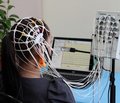 Кількісні лінійні ЕЕГ-властивості біоелектричної активності головного мозку у хворих із синдромами посткоматозного порушення свідомості після тяжкої ЧМТ
