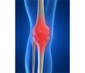 Peculiarities of course osteoarthritis of the knee joints depending on the degree of comorbidity and damage of hepatobiliary system