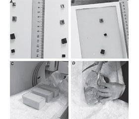 Оптимізація КТ-візуалізації при вогнепальних пораненнях: акцент на діагностичну точність