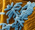 Pseudomonas aeruginosa: the modern reality of antibiotic therapy