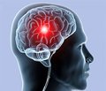 Клініко-нейрофізіологічна оцінка когнітивних порушень та професійної дезадаптації у пацієнтів з хронічною ішемією головного мозку