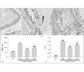 Ренопротекторний ефект метформіну в щурів із цукровим діабетом 2-го типу реалізується шляхом посилення експресії фактора пігментного епітелію в тканині нирок