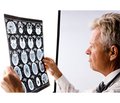 Особливості формування когнітивних порушень у хворих у віддаленому періоді черепно-мозкової травми