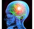 Черепно-мозговая травма в аспекте доказательной медицины: обзор актуальных международных рекомендаций