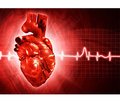 Myocardial infarction in young people