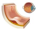 Pathogenesis of diabetic macular edema: the role of pro-inflammatory and vascular factors. A literature review