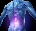 Важность нейротропного эффекта Нейробиона при лечении пациентов с болью в спине