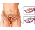 Polycystic Ovary Syndrome: Laboratory Diagnosis of Hyperandrogenic Status of a Woman (A Review of the Article «The Polycystic Ovary Syndrome: a Position Statement from the European Society of Endocrinology», October 2014)