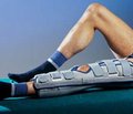 Результаты моделирования повреждений связочного аппарата коленного сустава