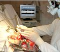 Оценка адекватности анестезии у пациентов, оперированных по поводу субтенториальных новообразований головного мозга