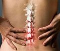 Аркоксия® — новые возможности  в лечении острого и хронического болевого синдрома в спине