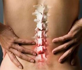 Аркоксия® — новые возможности  в лечении острого и хронического болевого синдрома в спине