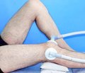 Ефективність Хондроцерину® після артроскопії при ушкодженні суглобового хряща колінного суглоба
