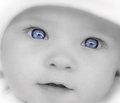 Гемодинамические сдвиги в сосудах глаз   и их коррекция у детей, больных хроническим   гломерулонефритом  