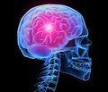 Принципы коррекции холинергической недостаточности, развивающейся  в восстановительном периоде лечения травматической болезни головного мозга  и мозгового инсульта