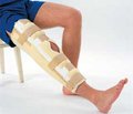 Хирургическое лечение околосуставных переломов длинных костей, образующих коленный сустав