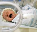 Формирование и прогноз эпилептических синдромов у детей, рожденных недоношенными