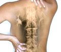 Локальная терапия в комплексном лечении пациентов старших возрастных групп с болью в нижней части спины  