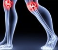Оптимизация топикальной терапии пациентов с остеоартрозом коленного сустава