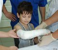 Лікування посттравматичних порушень репаративної регенерації переломів кісток у дітей  